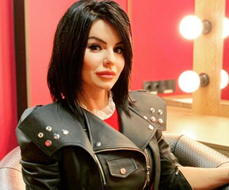 «Похожа на Майкла Джексона»: Юлия Волкова огорчила подписчиков «резиновым» лицом