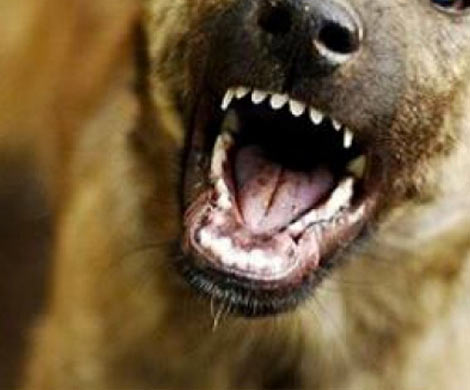 В Бузулукском районе ребенка сильно покусала домашняя собака‍